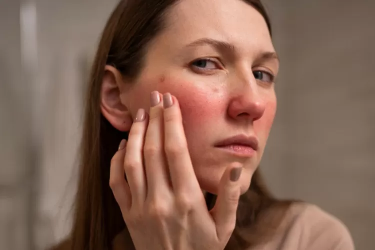 merawat kulit sensitif