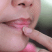 Penyebab Bibir Hitam dan Cara Mencerahkannya