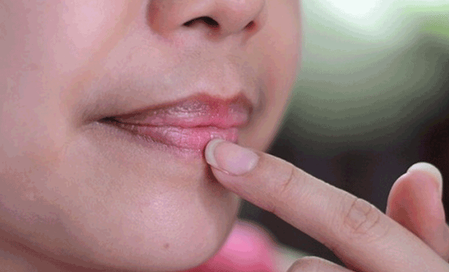Penyebab Bibir Hitam dan Cara Mencerahkannya