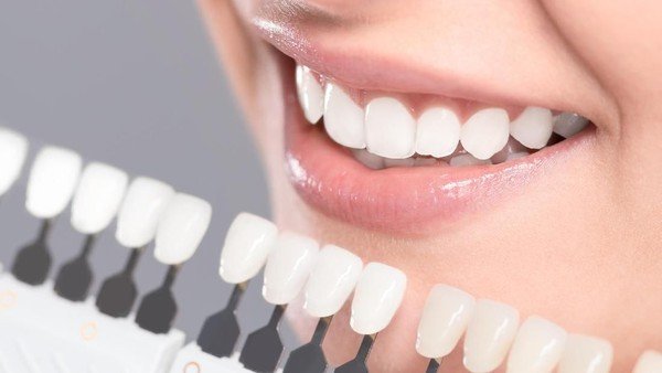 Veneer Gigi: