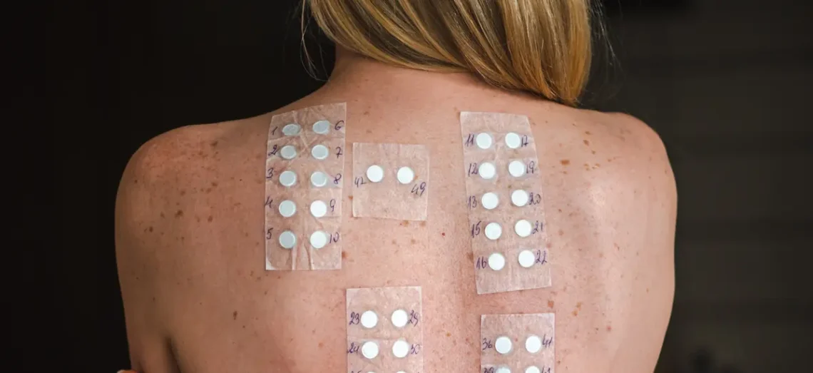 Patch Test: