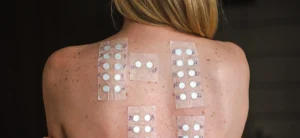 Patch Test: 
