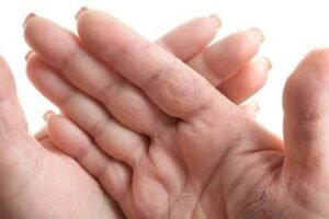 Cara Mengatasi Tangan Keriput dengan Bahan Alami