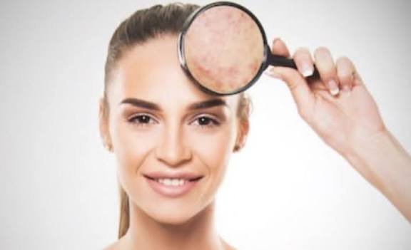 Jangan Salah Pilih Skincare!